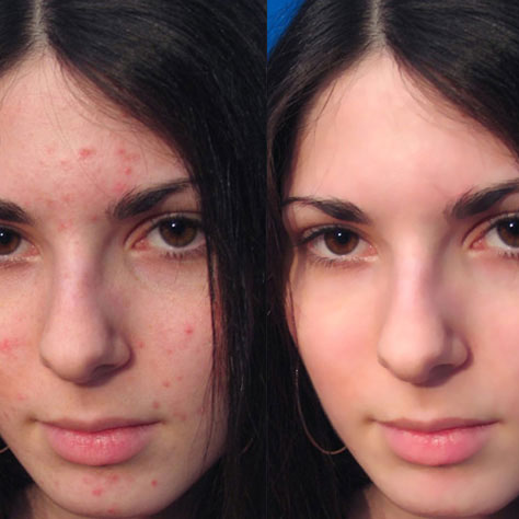 Photo Retouching Photoshop